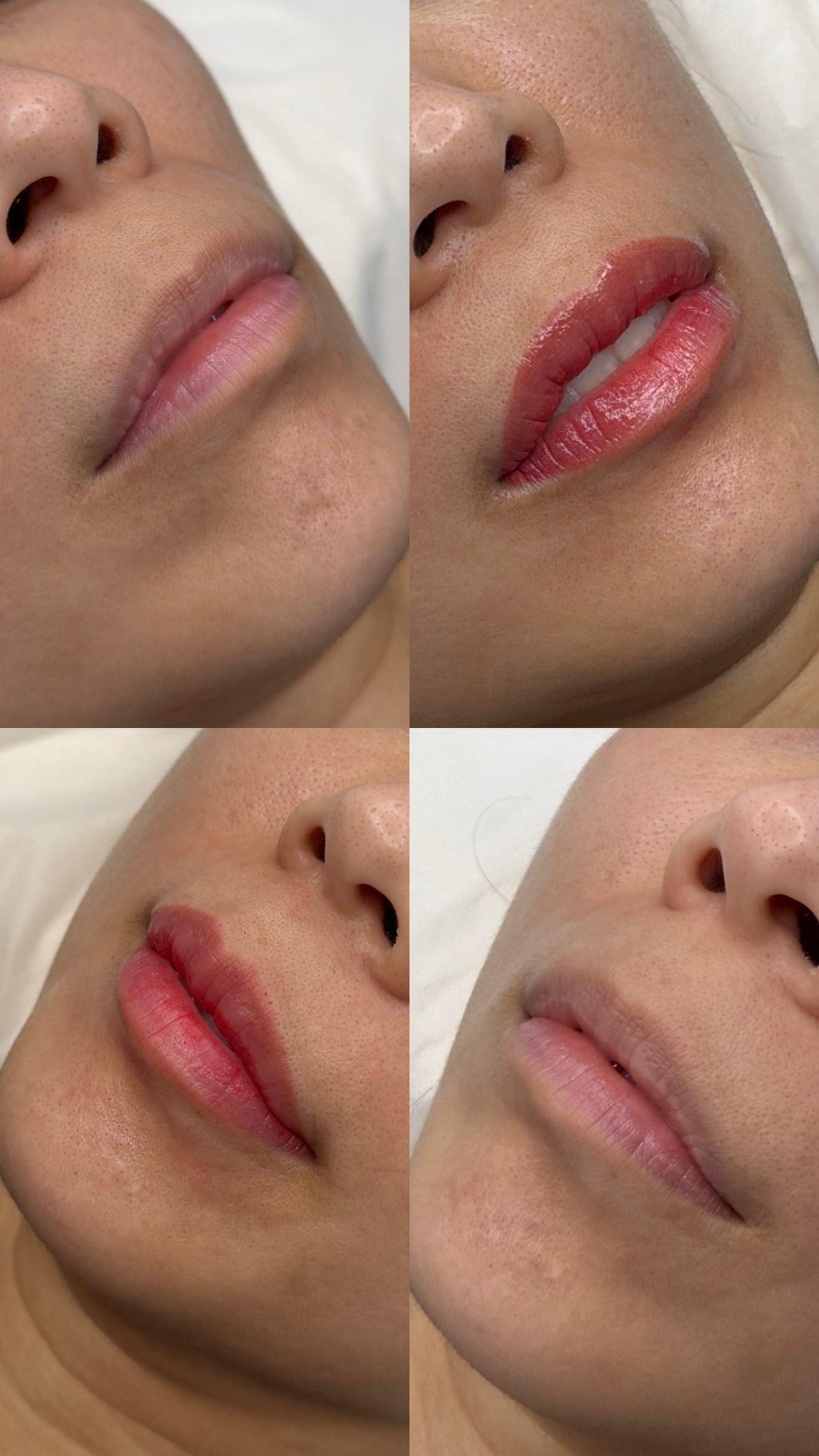 Studio Kypris lip blush before and after results